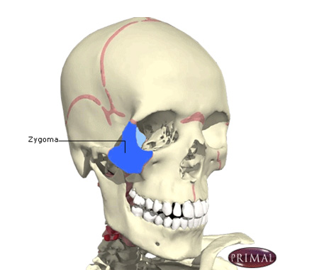 Zygomatic Complex and Nasal Injury